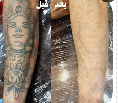 بهترین دکتر زیبایی در دزفول