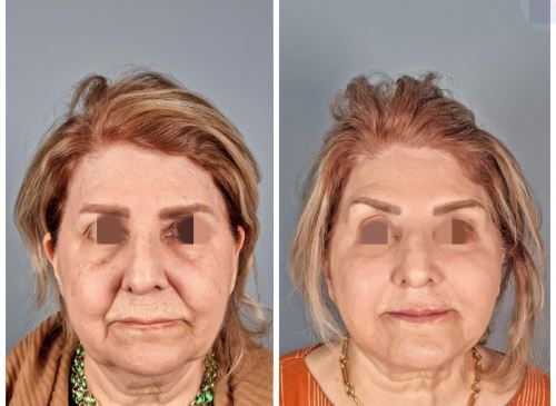 بهترین دکتر زیبایی در دزفول