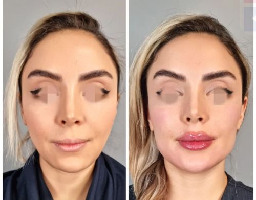 بهترین دکتر زیبایی در دزفول