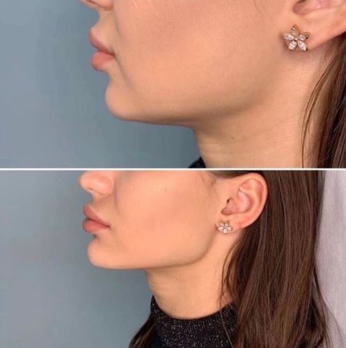 بهترین دکتر زیبایی در دزفول