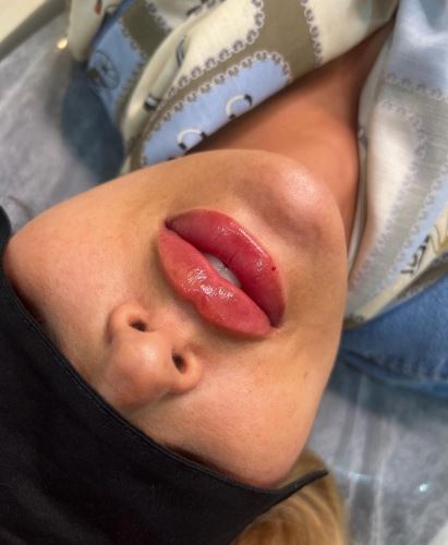 بهترین دکتر زیبایی در دزفول