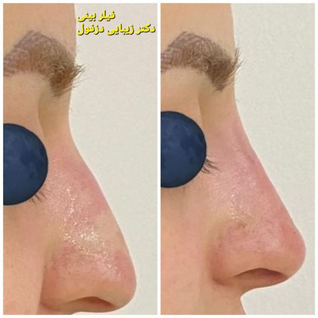 کلینیک زیبایی اورانوس دکتر وحید محمدی 09103300141