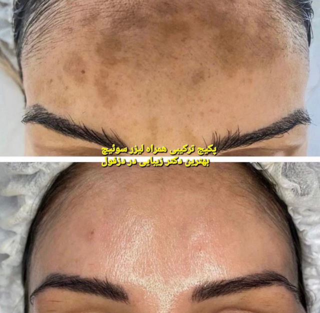 کلینیک زیبایی اورانوس دکتر وحید محمدی 09103300141