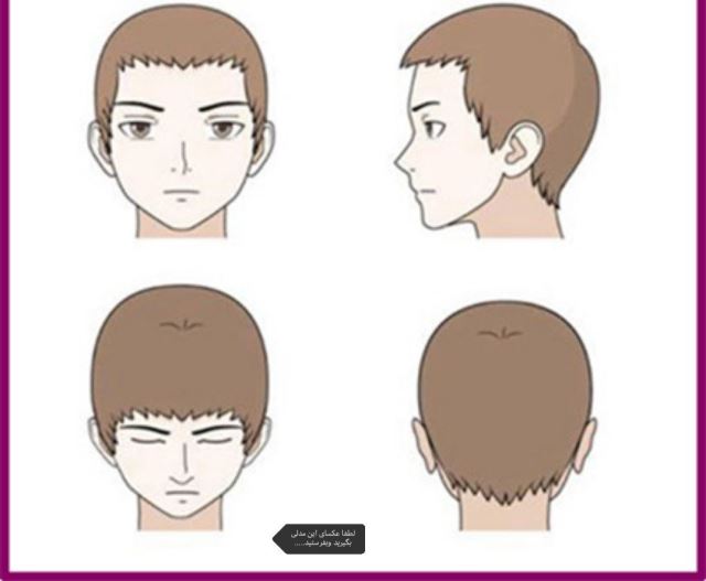 متخصص کاشت مو در شیراز