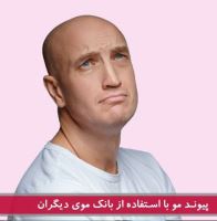 متخصص کاشت مو در شیراز