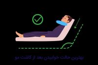 متخصص کاشت مو در شیراز