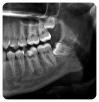 سونوگرافی ورادیولوژی پارس