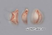 لابیا پلاستی خرم آباد