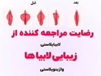 لابیا پلاستی خرم آباد