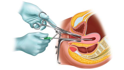 زیبایی بیکینی در خرم اباد