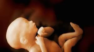 انجام زیبایی واژن خرم اباد