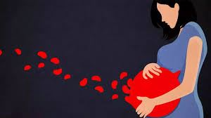 زیبایی واژن خرم اباد