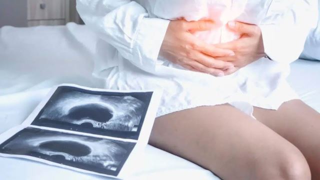 زیبایی واژن در خرم اباد