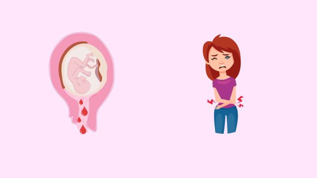 زیبایی واژن در خرم اباد