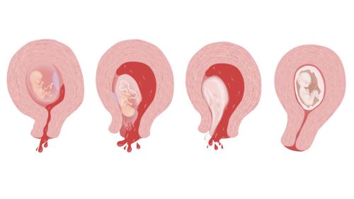 زیبایی لابیاپلاستی در خرم اباد