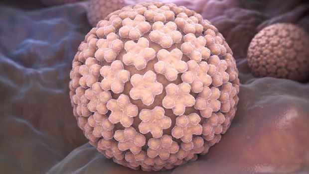 درمان قطعی زگیل تناسلی خرم اباد