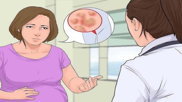 درمان قطعی زگیل تناسلی خرم اباد