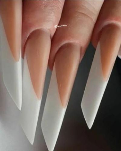 کاشت ژورنالی اچ