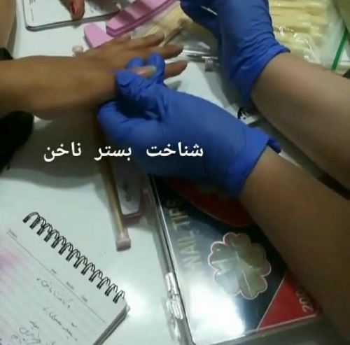 شناخت بستر ناخن