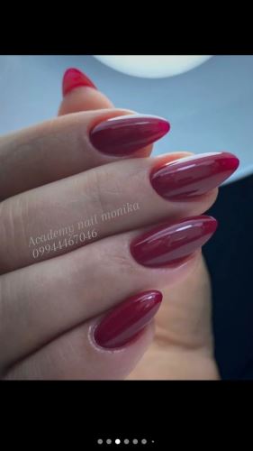 کاشت سالنی میندال