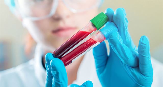 گرفتن آزمایش در منزل در شمال تهران 