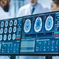 بهترین متخصص مغز و اعصاب کودکان در تهران