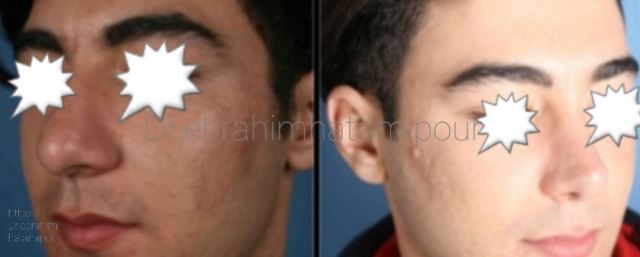 بهترین جراح بینی در شیراز