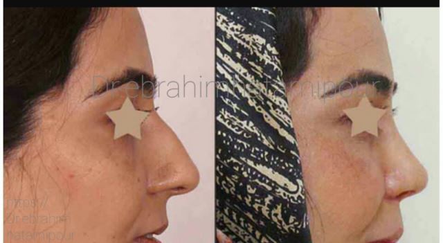 بهترین جراح بینی در شیراز