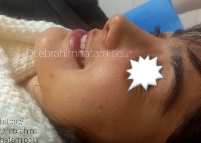 بهترین جراح بینی در شیراز