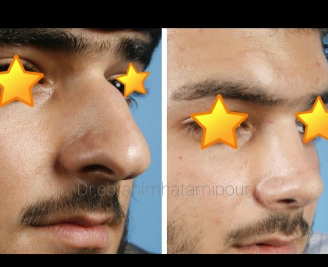 بهترین جراح بینی در شیراز