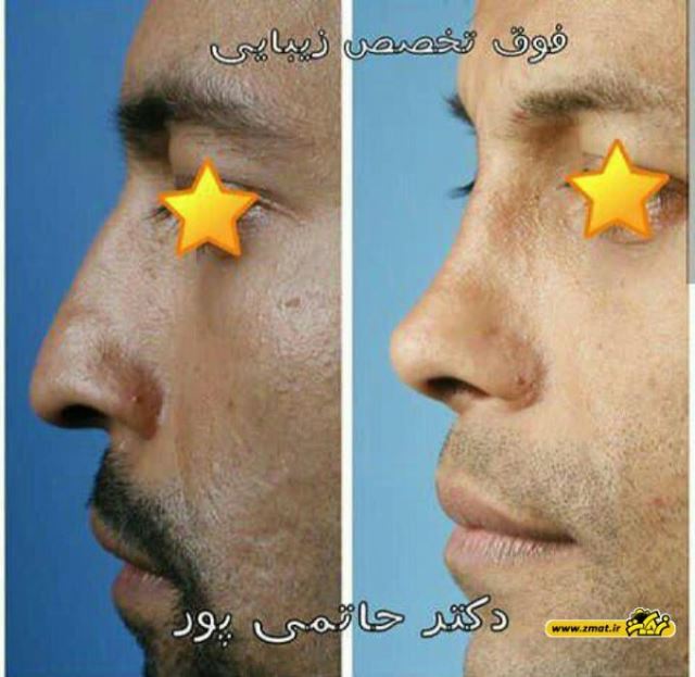 بهترین جراح بینی در شیراز