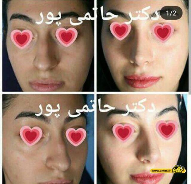 بهترین جراح بینی در شیراز