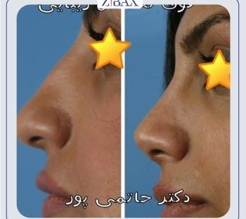 بهترین جراح بینی در شیراز