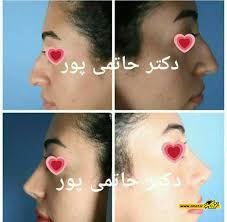 بهترین جراح بینی در شیراز