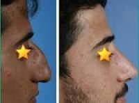بهترین جراح بینی در شیراز