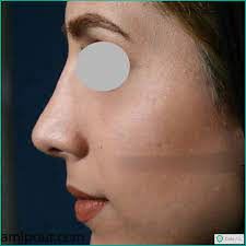 بهترین جراح بینی در شیراز