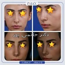 بهترین جراح بینی در شیراز