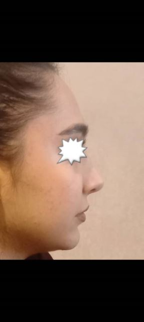 بهترین جراح بینی در شیراز