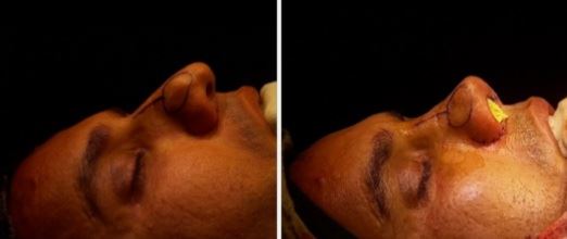 بهترین جراح بینی در شیراز