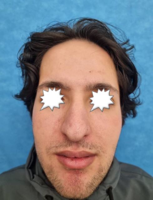 بهترین جراح بینی در شیراز