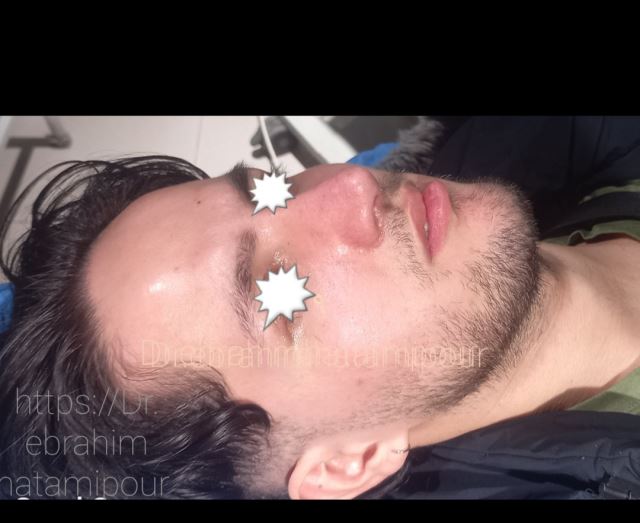 بهترین جراح بینی در شیراز