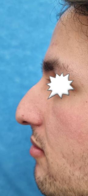 بهترین جراح بینی در شیراز