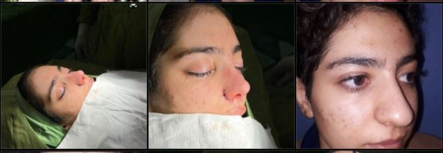 بهترین جراح بینی در شیراز