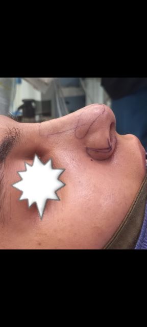 بهترین جراح بینی در شیراز