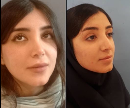 بهترین جراح بینی در شیراز