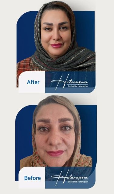 بهترین جراح بینی در شیراز
