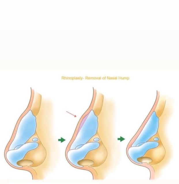 بهترین جراح بینی در شیراز