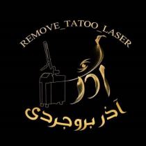 لیزر تاتو در زرین شهر