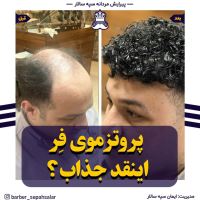 پروتز مو طبیعی بدون چسب