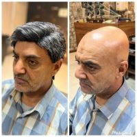 پروتز مو طبیعی بدون چسب